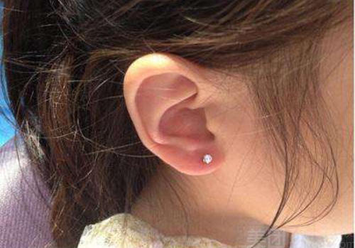 乖乖女高烧起红疹，确诊后痛哭不已，提醒：她的坏习惯很多人都有