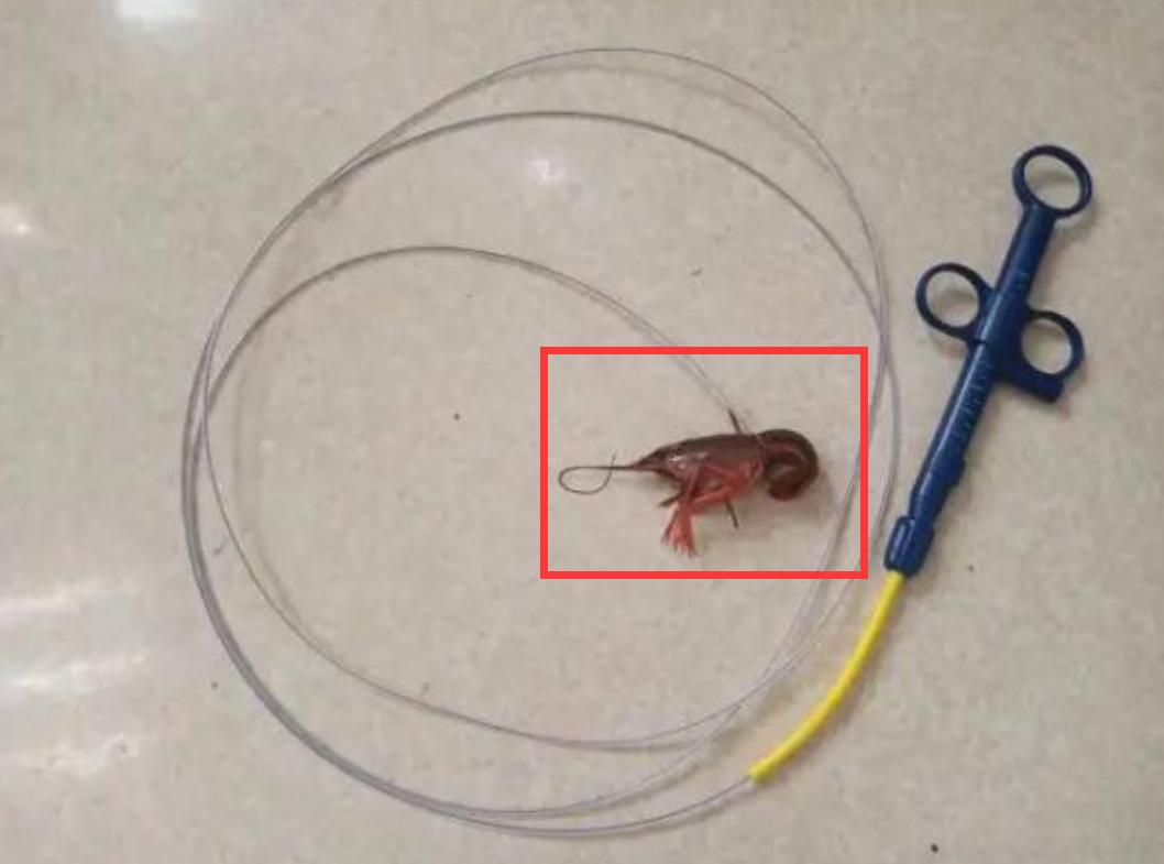 “医生救我！小龙虾越爬越凶！”浙江14岁男孩把小龙虾塞进肛门！称想把活龙虾变成龙虾干？