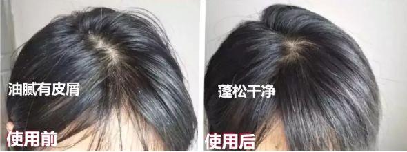 平价洗发水推荐男士去屑控油,价格平民又比较好用的洗发水推荐