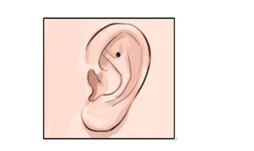 有痣的各个部位不好的痣详细图,各个部位有痣代表好看