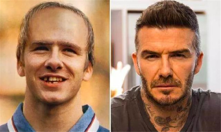 贝克汉姆头秃,贝克汉姆秃了头