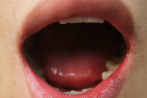 怎样才能让舌头变红,吃火龙果舌头变红怎么办