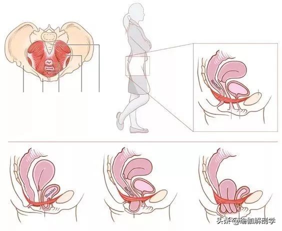 怎样有助于盆底肌修复 (多年盆底肌怎样才能修复)