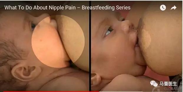 马蕾哺乳专家,马蕾医生科普视频