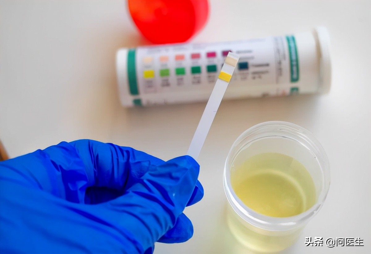 男性排尿尿道灼热用什么药,女性尿路感染会引起会阴处疼吗