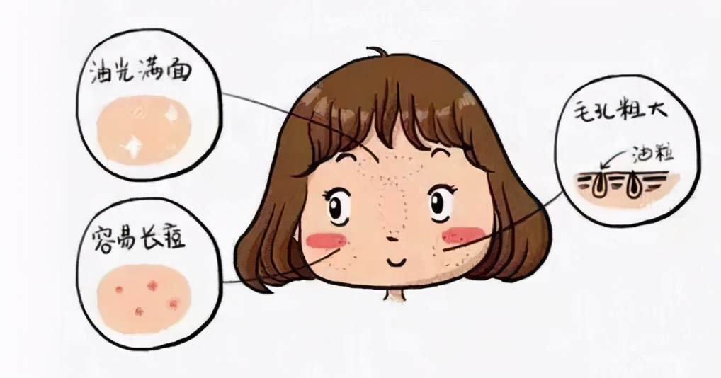 皮肤敏感肌全脸干脱皮,脸部泛红刺痛脱皮敏感肌怎么保湿