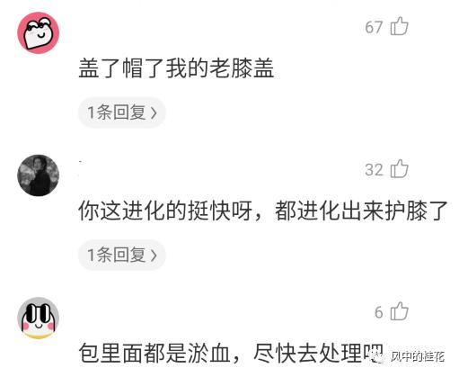 溜冰摔倒了膝盖不能弯曲,溜冰摔倒膝盖肿了怎么办