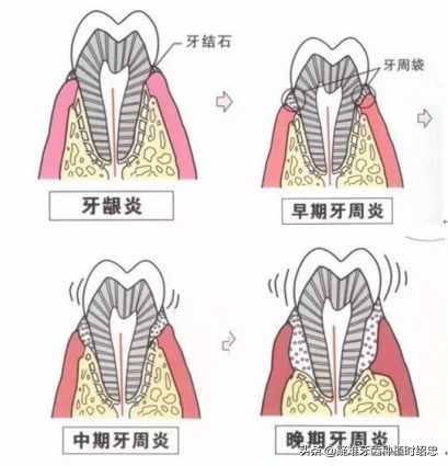 治牙费用一般多少钱,儿童治牙费用