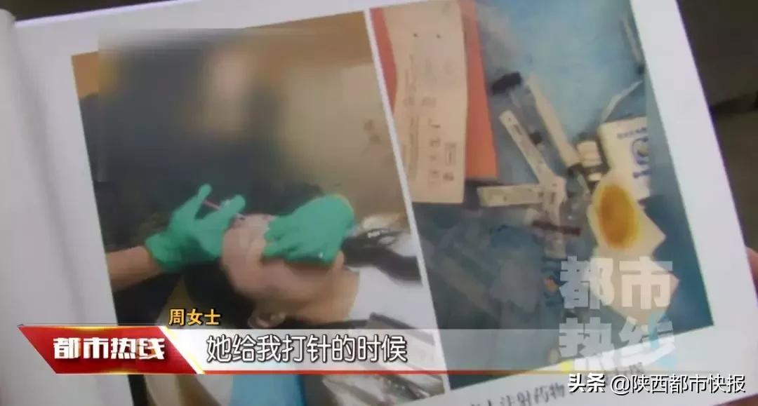 女子打童颜针修复,一女子打瘦脸针毁容