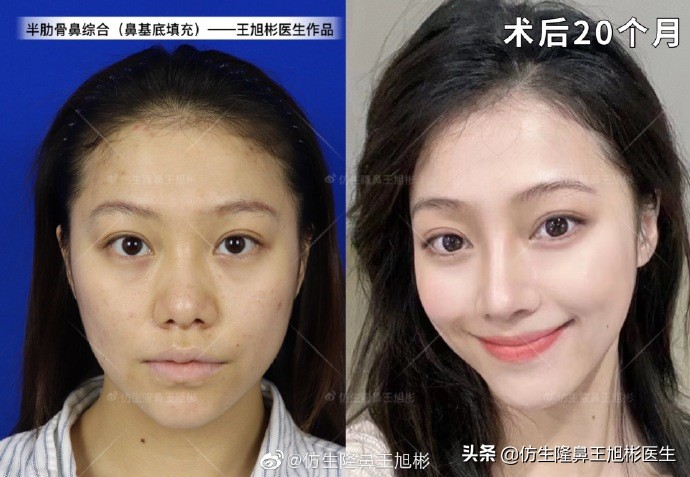 被鼻子封印的颜值,那些被鼻子封印的颜值