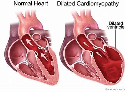 肝炎对心脏的影响,发现肝脏不好会引起什么症状