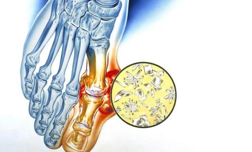 世界肾脏日肾脏健康关乎你我,世界肾脏日科普小知识