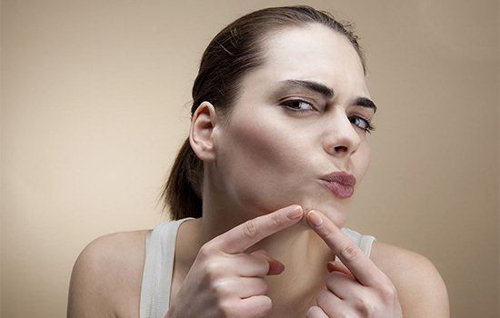 痘印淡化且不留痕迹方法男生,痘印有效去除