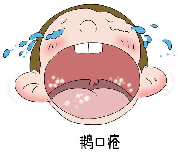 怀孕身体总是痒怎么办,怀孕身体瘙痒怎么办