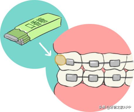 疫情复诊牙套能用吗现在,疫情期间牙齿出现问题怎么办