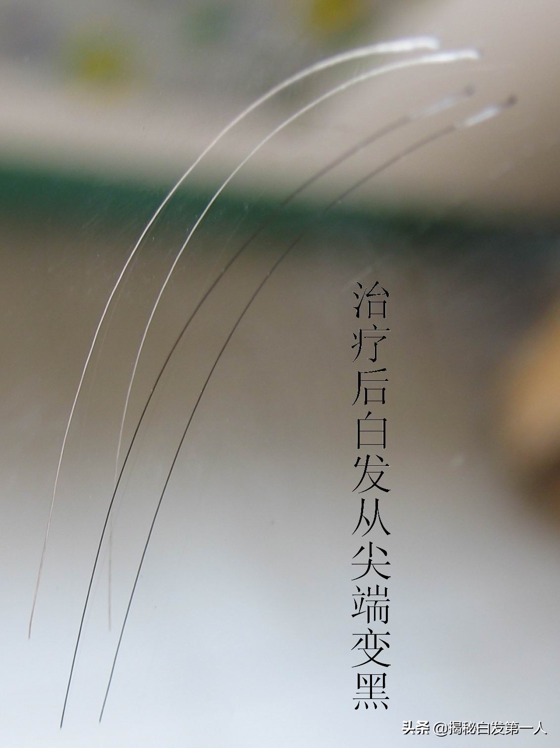 打疫苗的趣味话,3-11岁打新冠疫苗