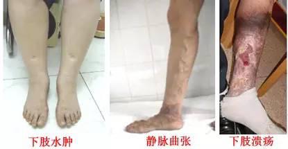 70岁老人不活动就感觉呼吸费劲,老人不咳但呼吸困难是什么原因