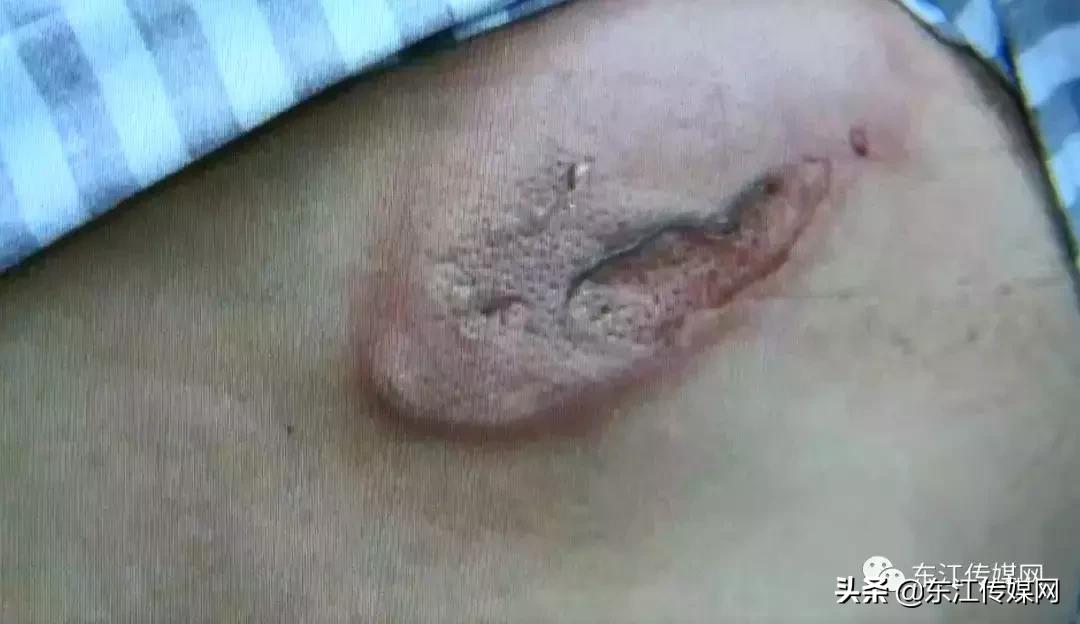 17岁学生疑触电,女子游泳池遭电晕