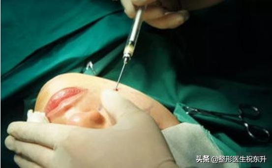 面部填充后吃什么对脂肪存活有利,脂肪填充多久脂肪存活稳定