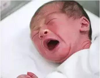 新生儿皮肤问题怎么解决,家有新生儿怎么办