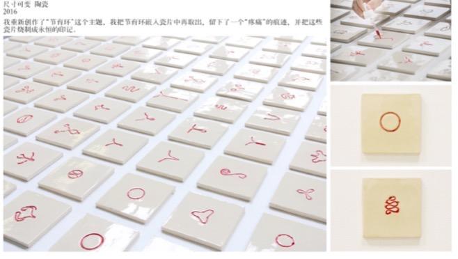 节育环在身体里40年了,遗忘在妈妈体内的节育环