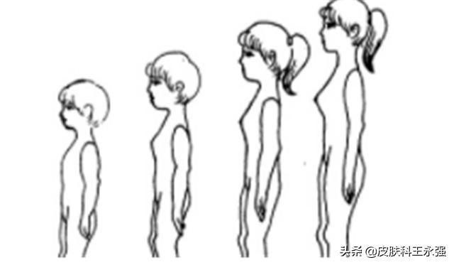 有女性身上不长毛毛是什么原因,女性皮肤多毛的原因