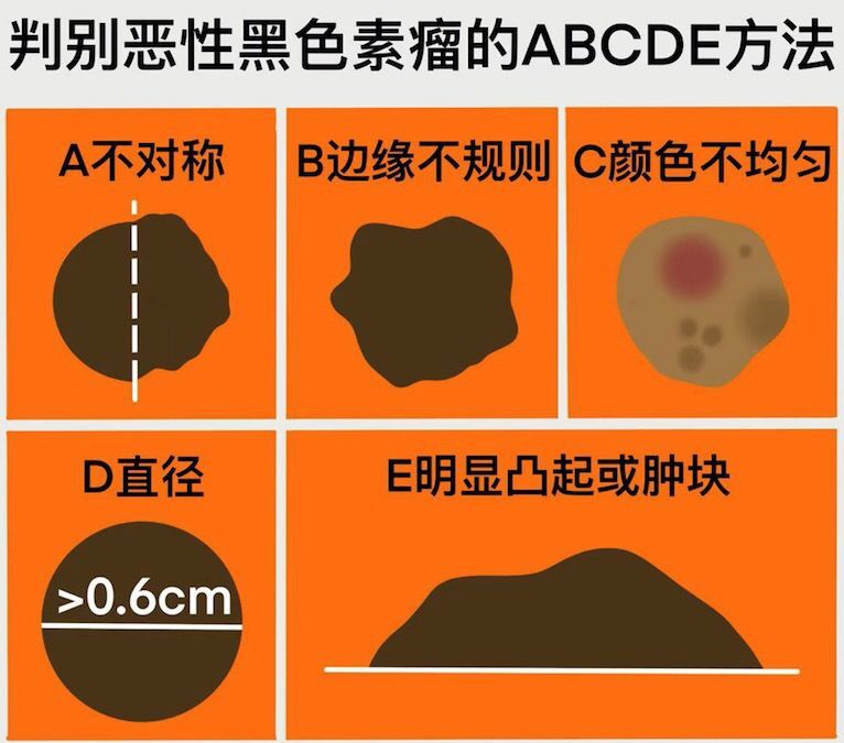 脸上痣掉了留下黑疤怎么处理,脸上痣怎么去除不留疤还安全