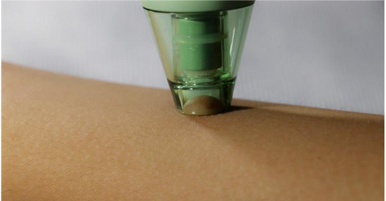 去黑头为什么黑头越来越多,长了黑头到底能不能挤