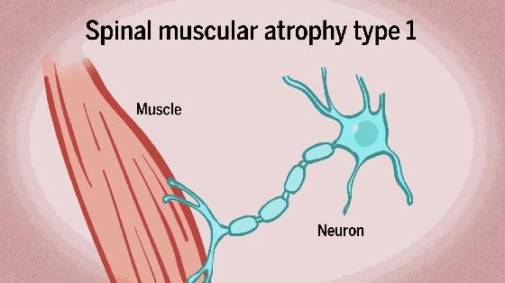 最贵的药1448万叫什么名字,1348万元的天价药