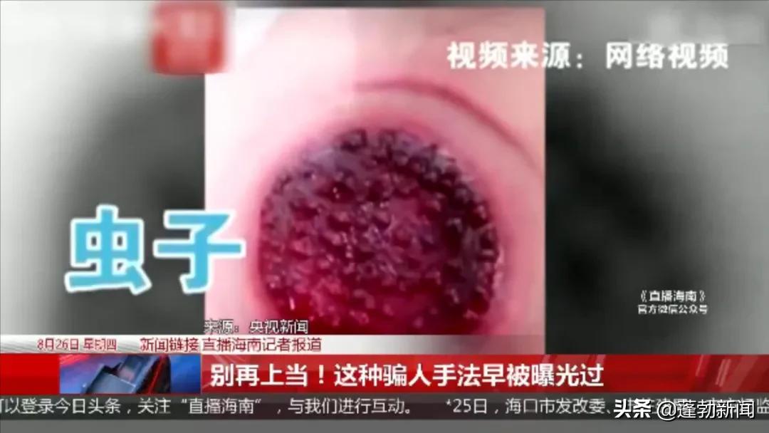 临高一村里开了家理疗馆,号称拔罐就能病除,真有这么神奇?