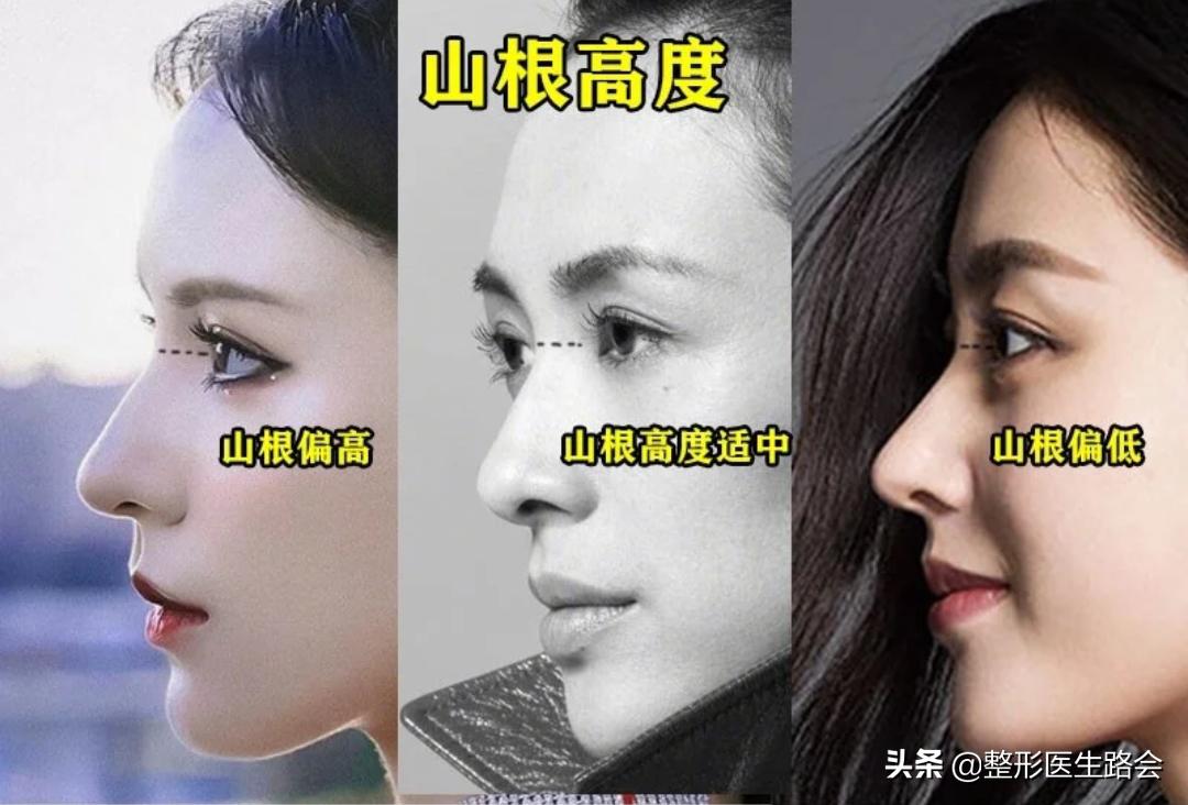 直鼻、直鼻微翘、翘鼻、微驼峰，好看的鼻子怎么选？