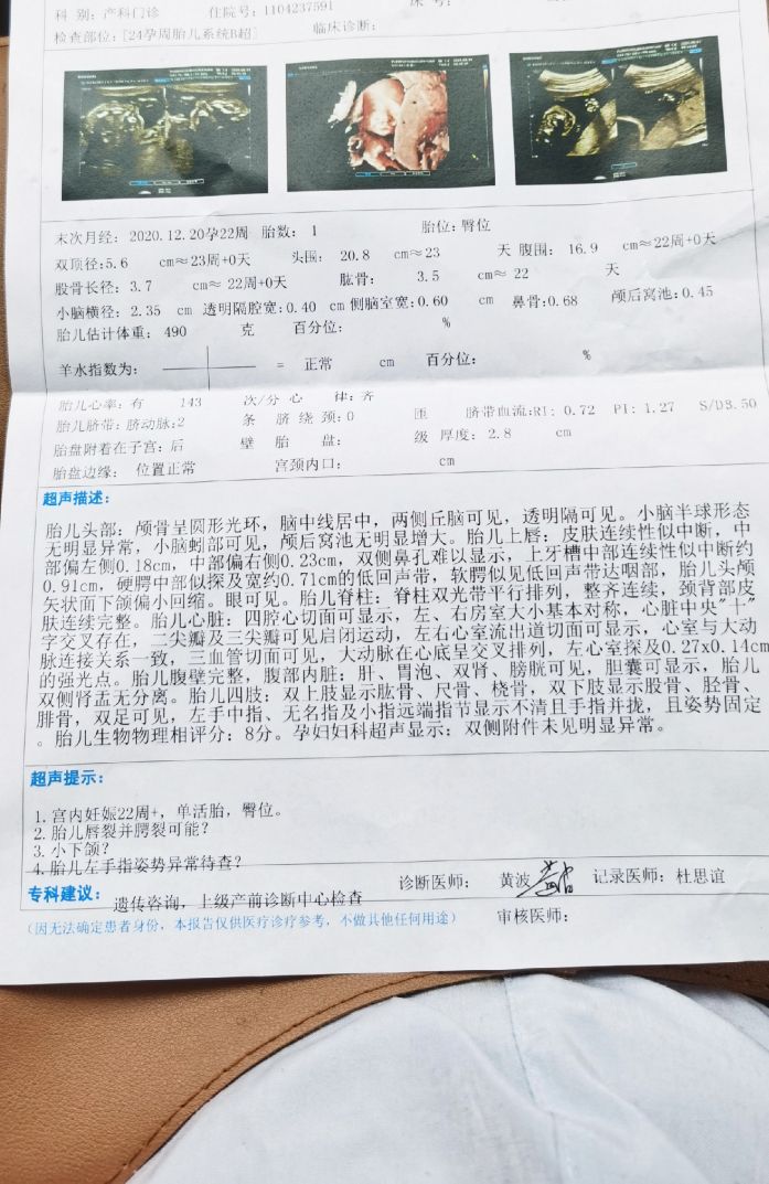23周胎儿引产的真实感受,足月胎儿畸形引产的真实经历
