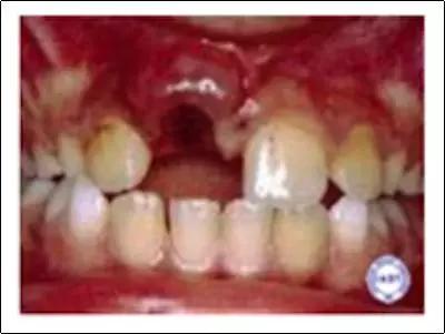 牙痛小知识科普,牙痛小常识分享给大家