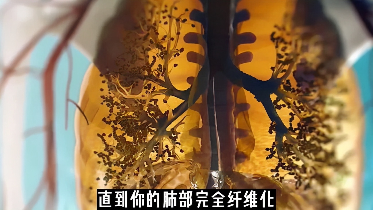 13岁女孩喝下百草枯后续最近消息,13岁女孩喝下百草枯事件全过程