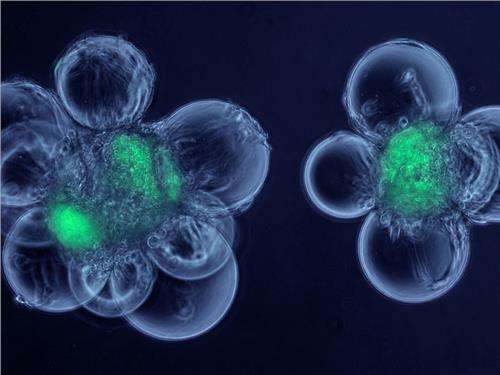 慢粒白血病知识讲座,慢粒白血病基因检测多少为安全