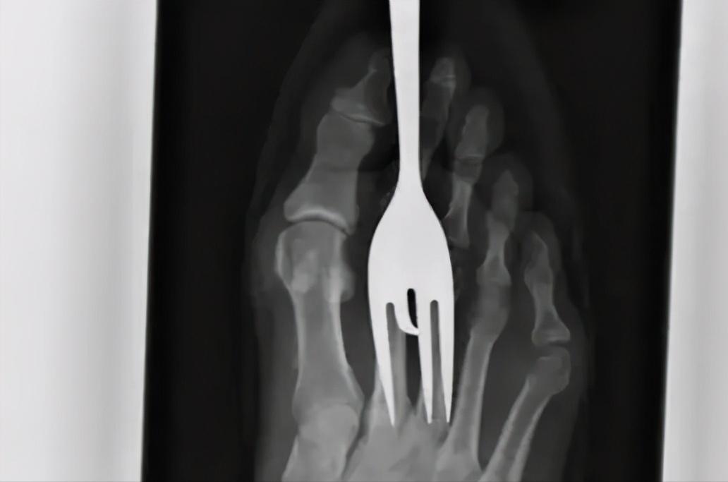 50cm“仙女管”插入少女胃里,这种自虐工具竟在淘宝卖疯了