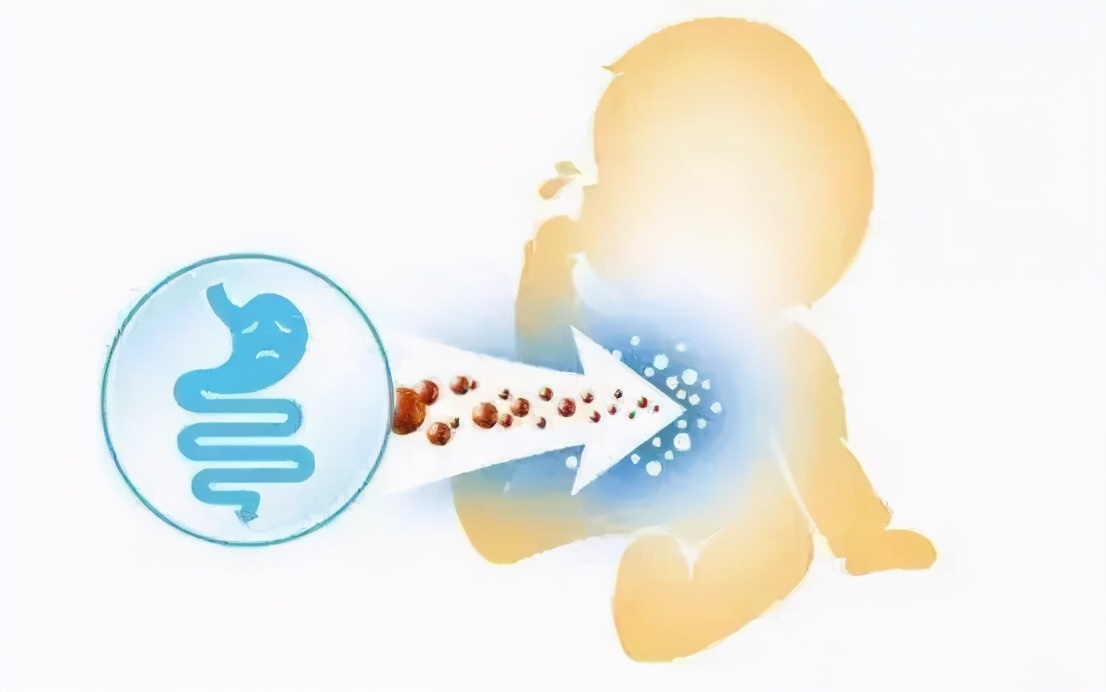 剖腹产出来的婴儿怎么喂养,剖宫产新生儿如何喂养