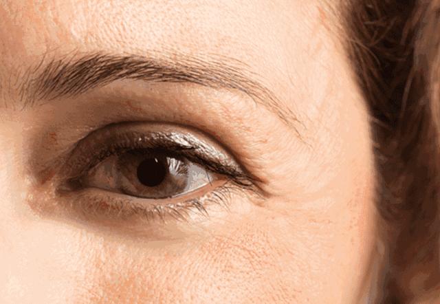眼部护理大揭秘改善眼纹,眼部眼纹保养
