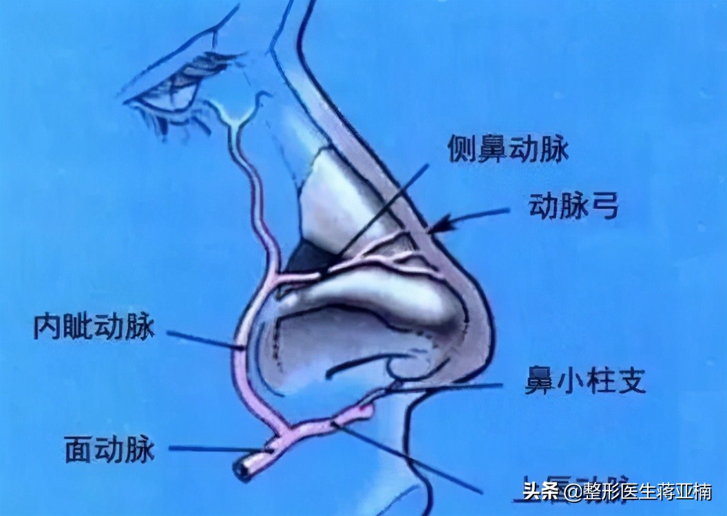 什么鼻整形需要经常修复,如何快速恢复隆鼻手术