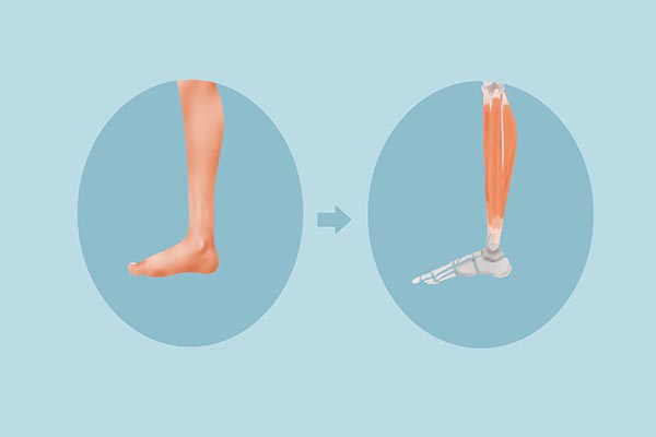 什么是筋膜炎？筋膜炎上身时，哪些地方会感觉到疼痛？