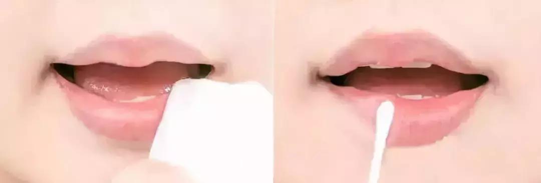 唇纹深显老吗,唇纹深好不好