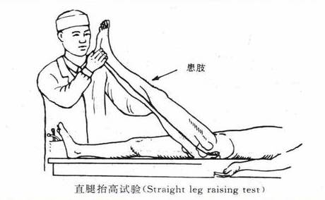 腰椎间盘突出症的临床诊治策略,腰椎间盘突出症的临床诊治