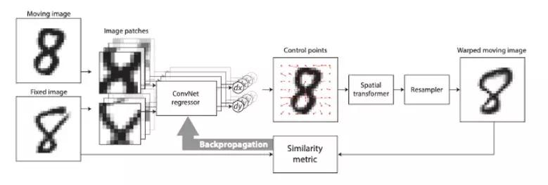 图像配准的前世今生：从人工设计特征到深度学习