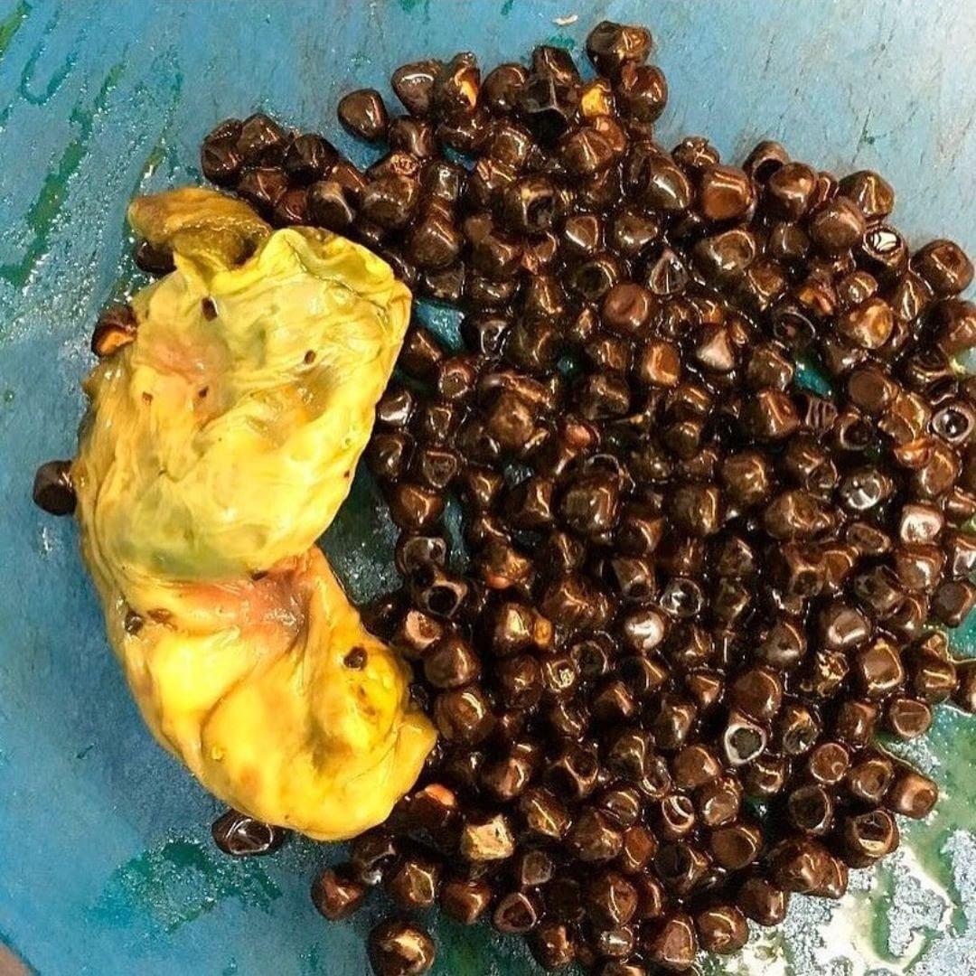 医生辟谣手术,医生辟谣剖腹产出院