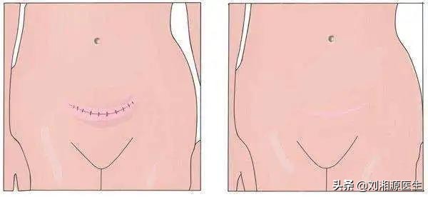 免疫治疗不良反应科普图文,免疫因素怀孕早期保胎几率大吗