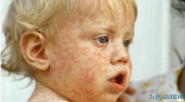 最危险的10种致命病毒,世界最难治病毒