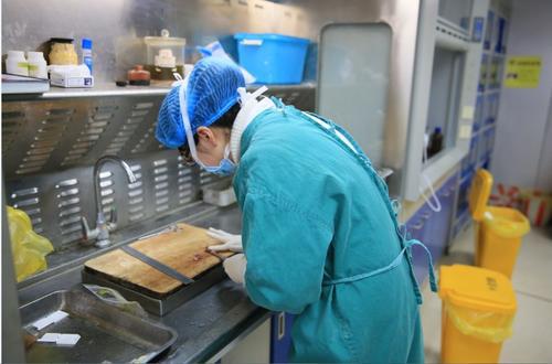 确诊腺肌症的检查是什么,确诊腺肌症要查什么