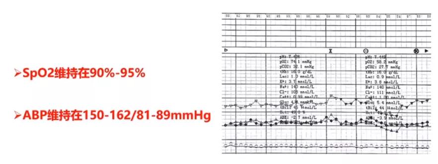 先天性心脏病肺动脉高压开胸手术,先心病导致的肺动脉高压手术治疗