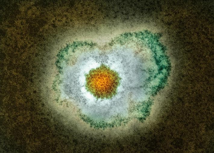 中医治疗单纯疱疹的最佳方法,中医怎么治疗单纯疱疹