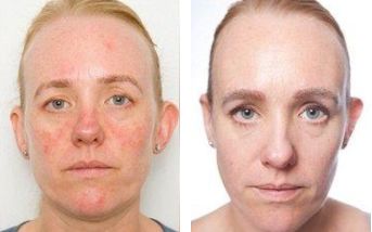 抗氧化修护面霜,修复维稳抗老大牌精华和面霜